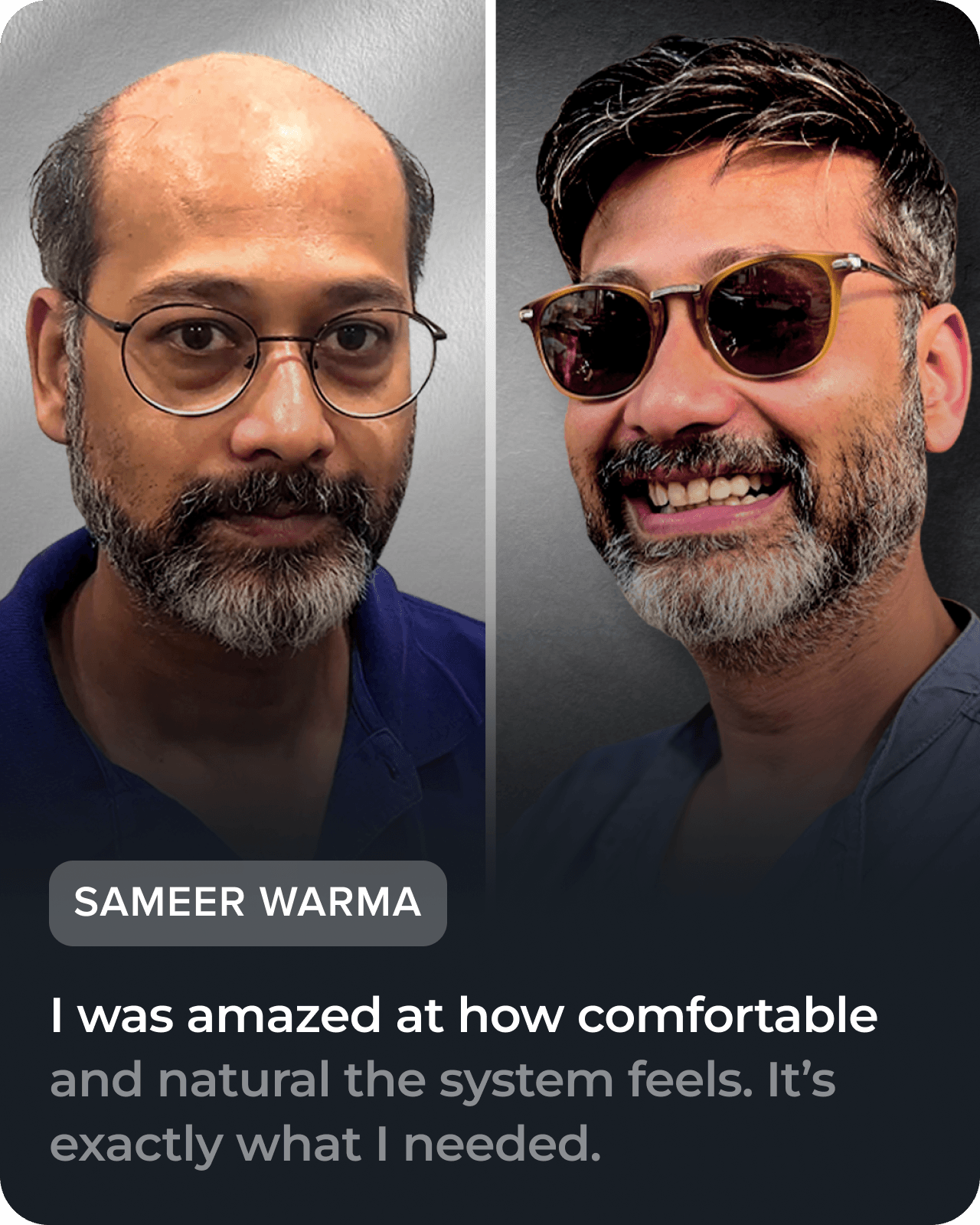 Before and after hair restoration testimonial, slide 1