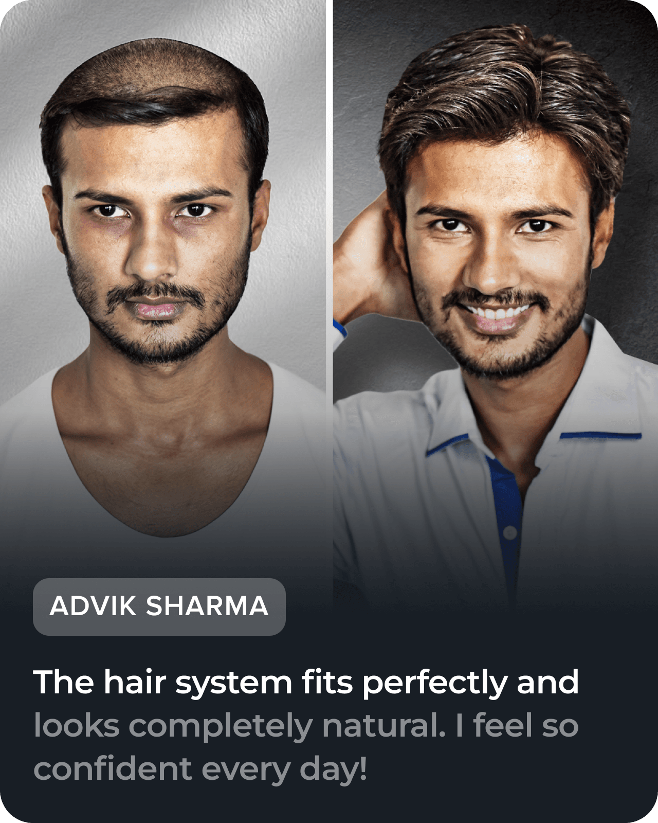 Before and after hair restoration testimonial, slide 3