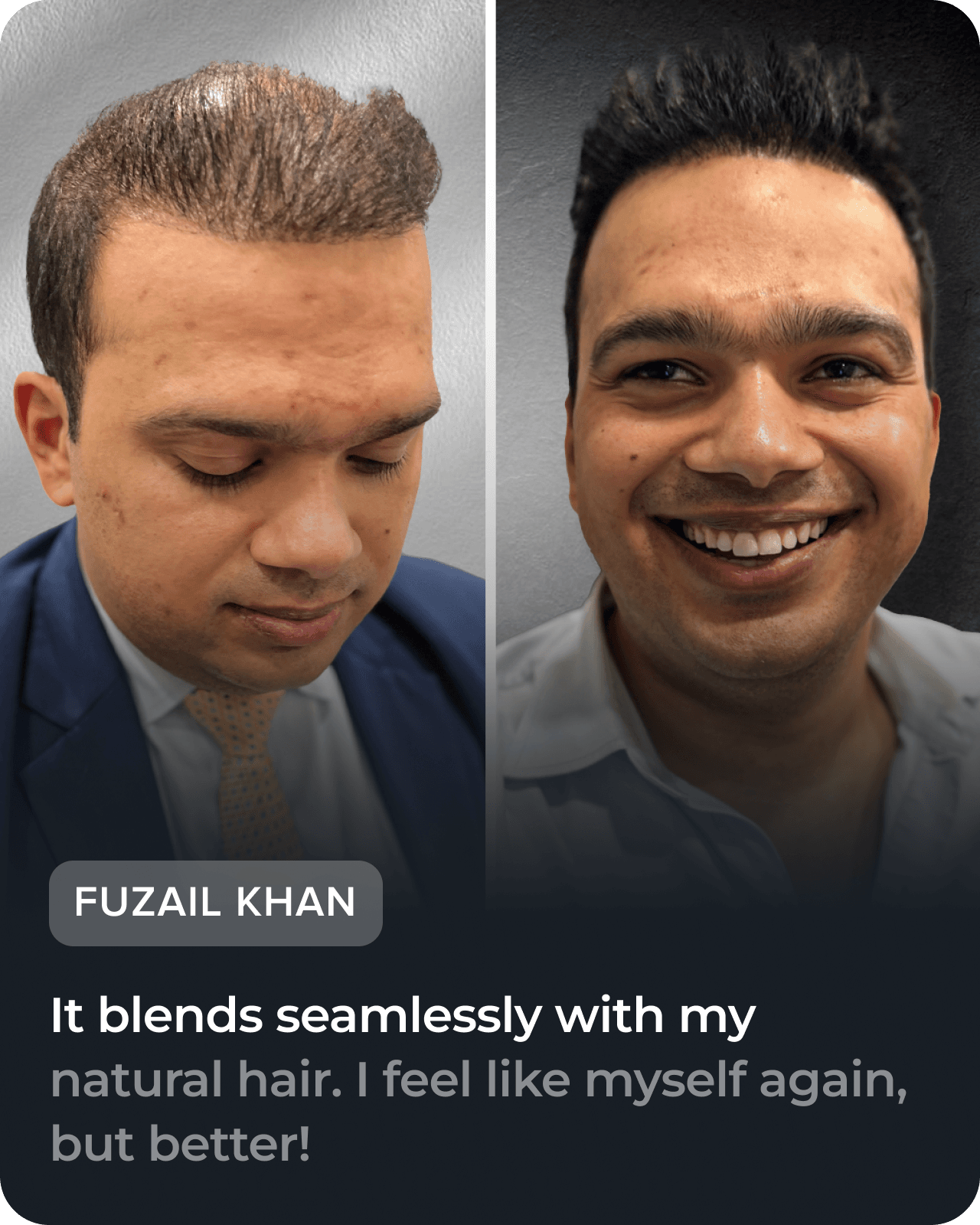 Before and after hair restoration testimonial, slide 4