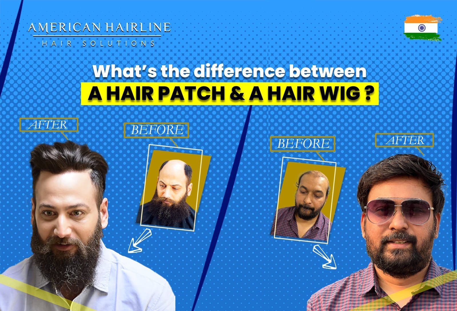 What's the Difference Between a Hair Patch and a Hair Wig?