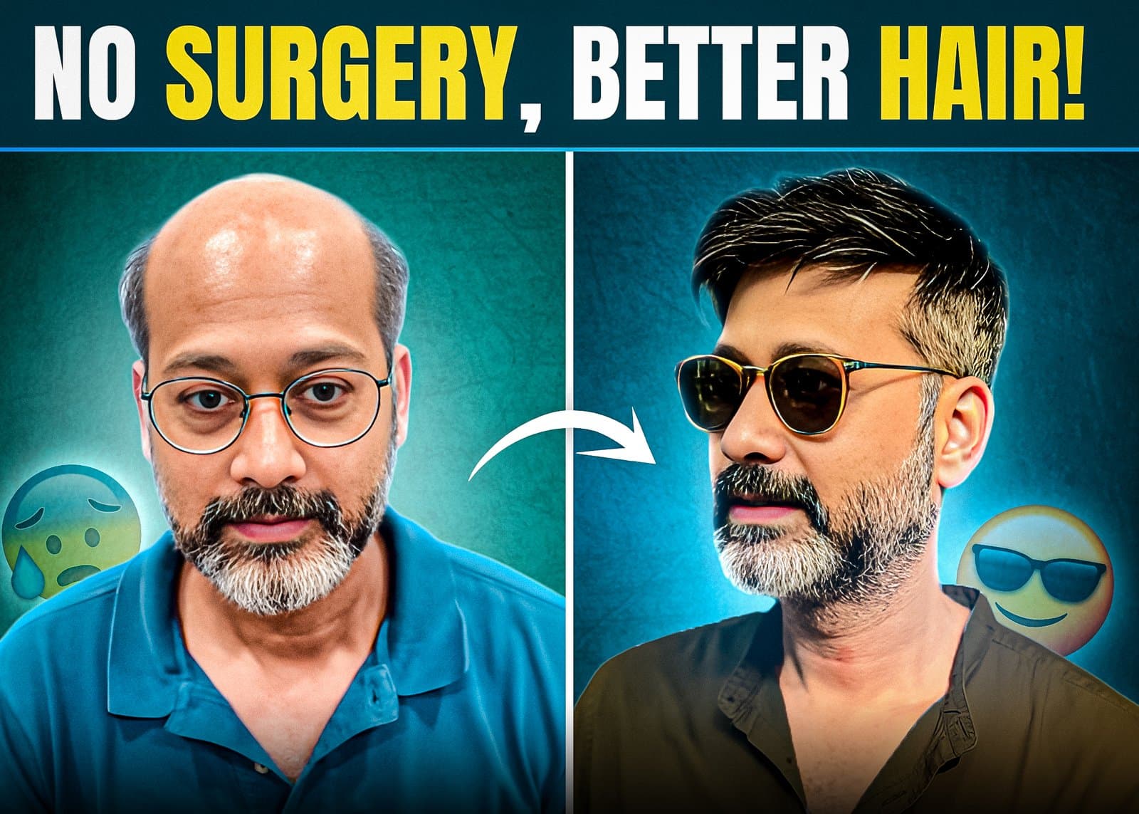 Why Are Stick-On Hair Systems Outsmarting Hair Transplants in India?