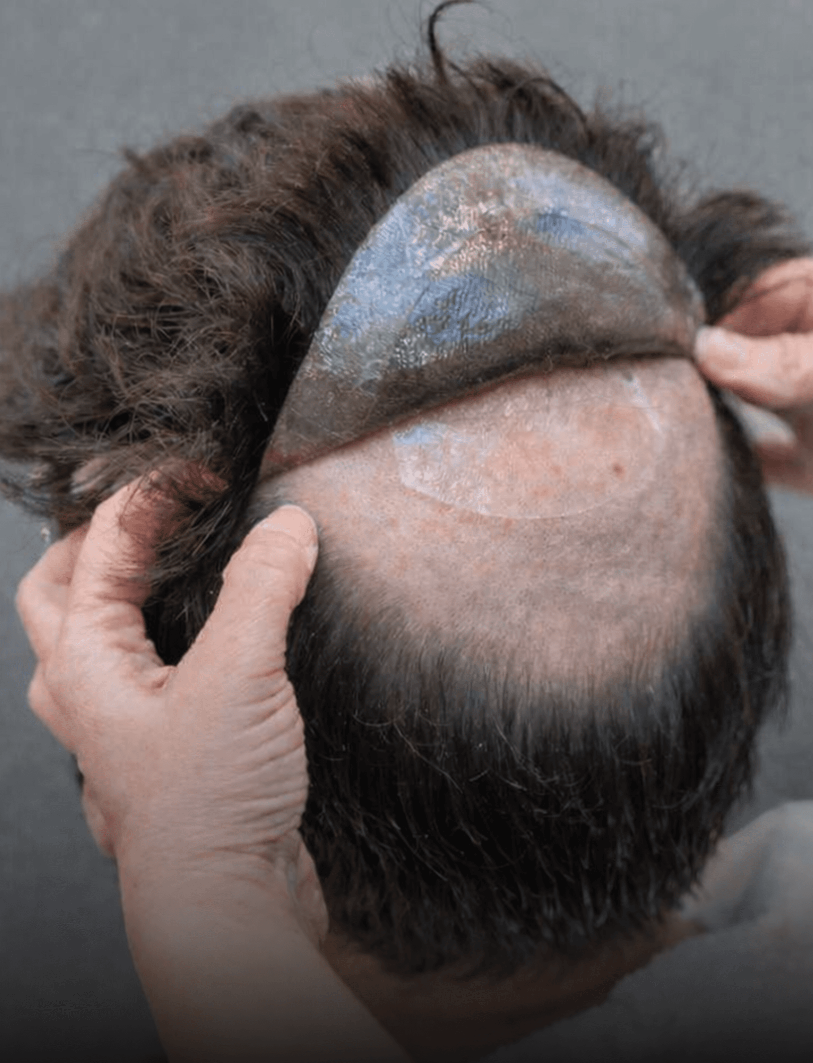Stick-on hair system method preview
