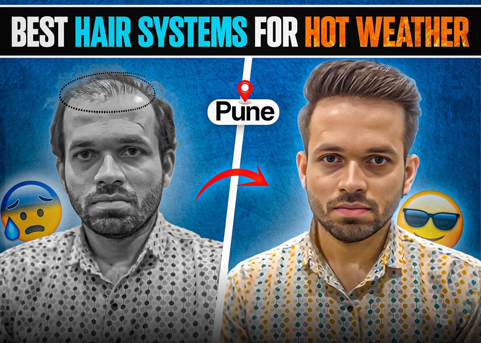Best Hair Patches for Pune's Hot and Humid Weather